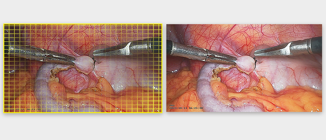 4K熒光內窺鏡攝像系統 4K熒光內窺鏡攝像系統