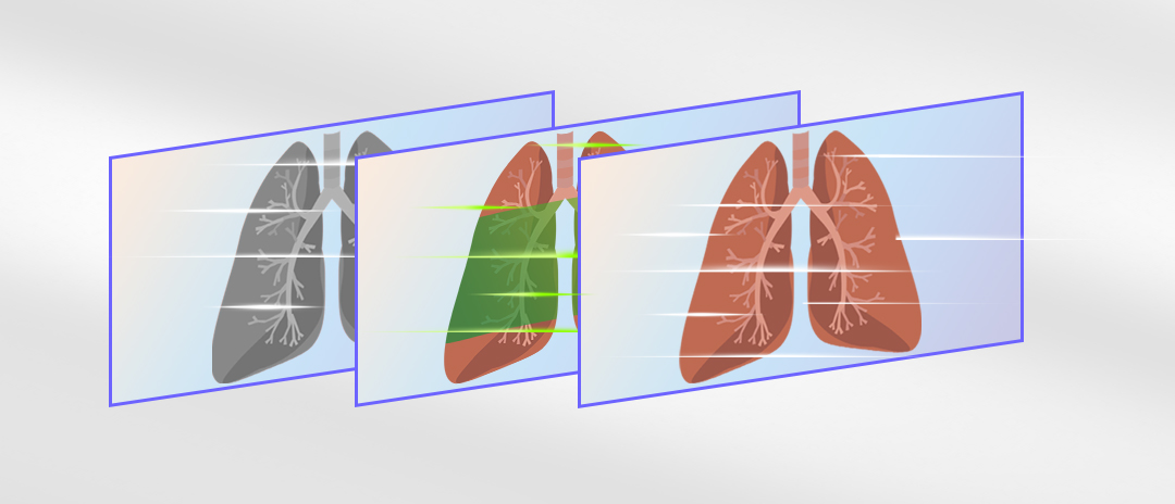 4K熒光內窺鏡攝像系統 4K熒光內窺鏡攝像系統